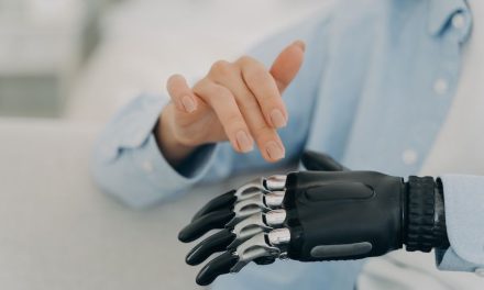 An artificial helping hand: Improving prosthetic design and manufacture with electronic drive systems